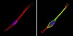 IGF2R Antibody in Immunocytochemistry (ICC/IF)