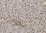 MTA3 Antibody in Immunohistochemistry (Paraffin) (IHC (P))