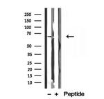 MTA3 Antibody in Western Blot (WB)