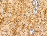 TELO2 Antibody in Immunohistochemistry (Paraffin) (IHC (P))