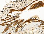 ACSL4 Antibody in Immunohistochemistry (Paraffin) (IHC (P))