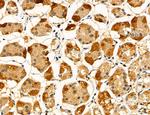 ACSL4 Antibody in Immunohistochemistry (Paraffin) (IHC (P))