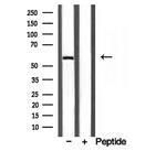 D2HGDH Antibody in Western Blot (WB)