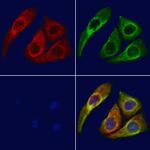 ERO1LB Antibody in Immunocytochemistry (ICC/IF)