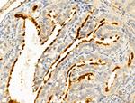 ERO1LB Antibody in Immunohistochemistry (Paraffin) (IHC (P))