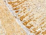 ERO1LB Antibody in Immunohistochemistry (Paraffin) (IHC (P))