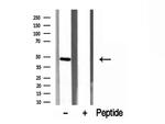 ERO1LB Antibody in Western Blot (WB)