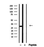 DNAJB3 Antibody in Western Blot (WB)