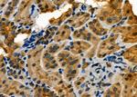 PER2 Antibody in Immunohistochemistry (Paraffin) (IHC (P))