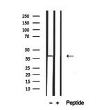 SLC10A2 Antibody in Western Blot (WB)