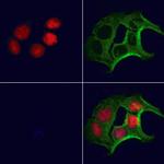 Folliculin Antibody in Immunocytochemistry (ICC/IF)