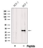 HDGFRP3 Antibody in Western Blot (WB)