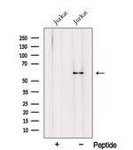 RIC8A Antibody in Western Blot (WB)