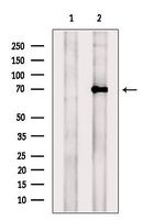 TRPV6 Antibody in Western Blot (WB)