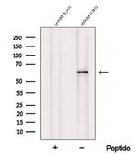 ZNF238 Antibody in Western Blot (WB)