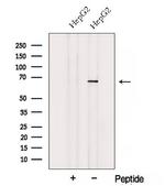 ACSM3 Antibody in Western Blot (WB)