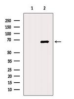 ACSM3 Antibody in Western Blot (WB)