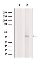 AIPL1 Antibody in Western Blot (WB)