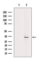 Clathrin Light Chain Antibody in Western Blot (WB)