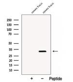 Clathrin Light Chain Antibody in Western Blot (WB)