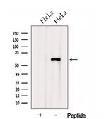 STCH Antibody in Western Blot (WB)