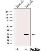 C14orf179 Antibody in Western Blot (WB)