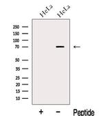 RKHD2 Antibody in Western Blot (WB)