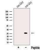 MSRA Antibody in Western Blot (WB)