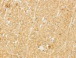 MYOF Antibody in Immunohistochemistry (Paraffin) (IHC (P))