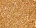 MYOF Antibody in Immunohistochemistry (Paraffin) (IHC (P))