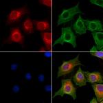 OGDHL Antibody in Immunocytochemistry (ICC/IF)