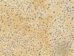 OGDHL Antibody in Immunohistochemistry (Paraffin) (IHC (P))