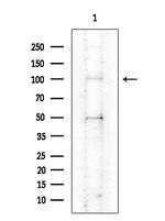 ATP12A Antibody in Western Blot (WB)