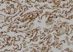 SH3BP2 Antibody in Immunohistochemistry (Paraffin) (IHC (P))