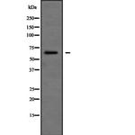 SH3BP2 Antibody in Western Blot (WB)