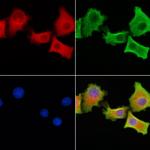 SLC34A2 Antibody in Immunocytochemistry (ICC/IF)