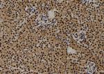 CENPF Antibody in Immunohistochemistry (Paraffin) (IHC (P))