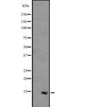 PHLDA3 Antibody in Western Blot (WB)