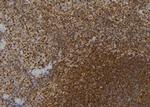 ZNF416 Antibody in Immunohistochemistry (Paraffin) (IHC (P))