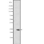 MED20 Antibody in Western Blot (WB)