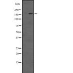 DOT1L Antibody in Western Blot (WB)