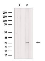 Kallikrein 12 Antibody in Western Blot (WB)