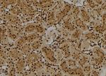 FUBP1 Antibody in Immunohistochemistry (Paraffin) (IHC (P))