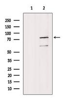 FUBP1 Antibody in Western Blot (WB)