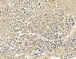 CYP7B1 Antibody in Immunohistochemistry (Paraffin) (IHC (P))