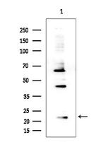 RPS15 Antibody in Western Blot (WB)