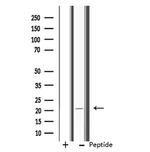 RPL11 Antibody in Western Blot (WB)