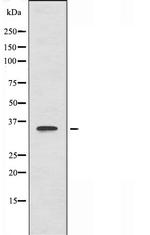 B3GALT1 Antibody in Western Blot (WB)
