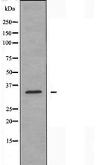 Carbonic Anhydrase VI Antibody in Western Blot (WB)