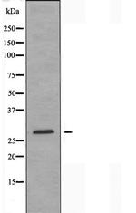 CBLN4 Antibody in Western Blot (WB)